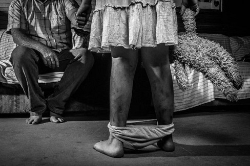 PROBLEMA SOCIAL GRAVE EN PARAGUAY ES LA EXPLOTACIÓN SEXUAL DE NIÑOS